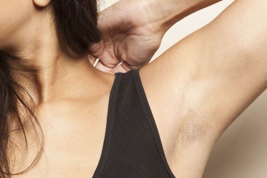 Dark underarms - Causes and how can they be treated?